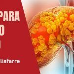 Hígado graso: dieta y estilo de vida asociado dieta hígado graso